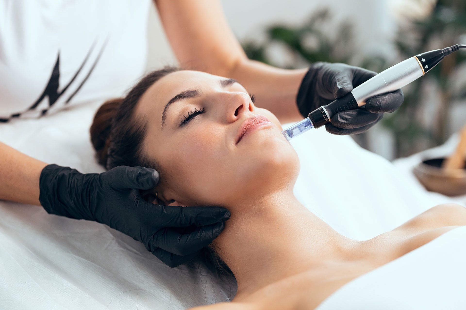 Golden Needle/Microneedling
